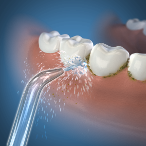 Waterpik końcówki wymienne do irygatora WP-100, WP-360, WP-450, (2 szt)